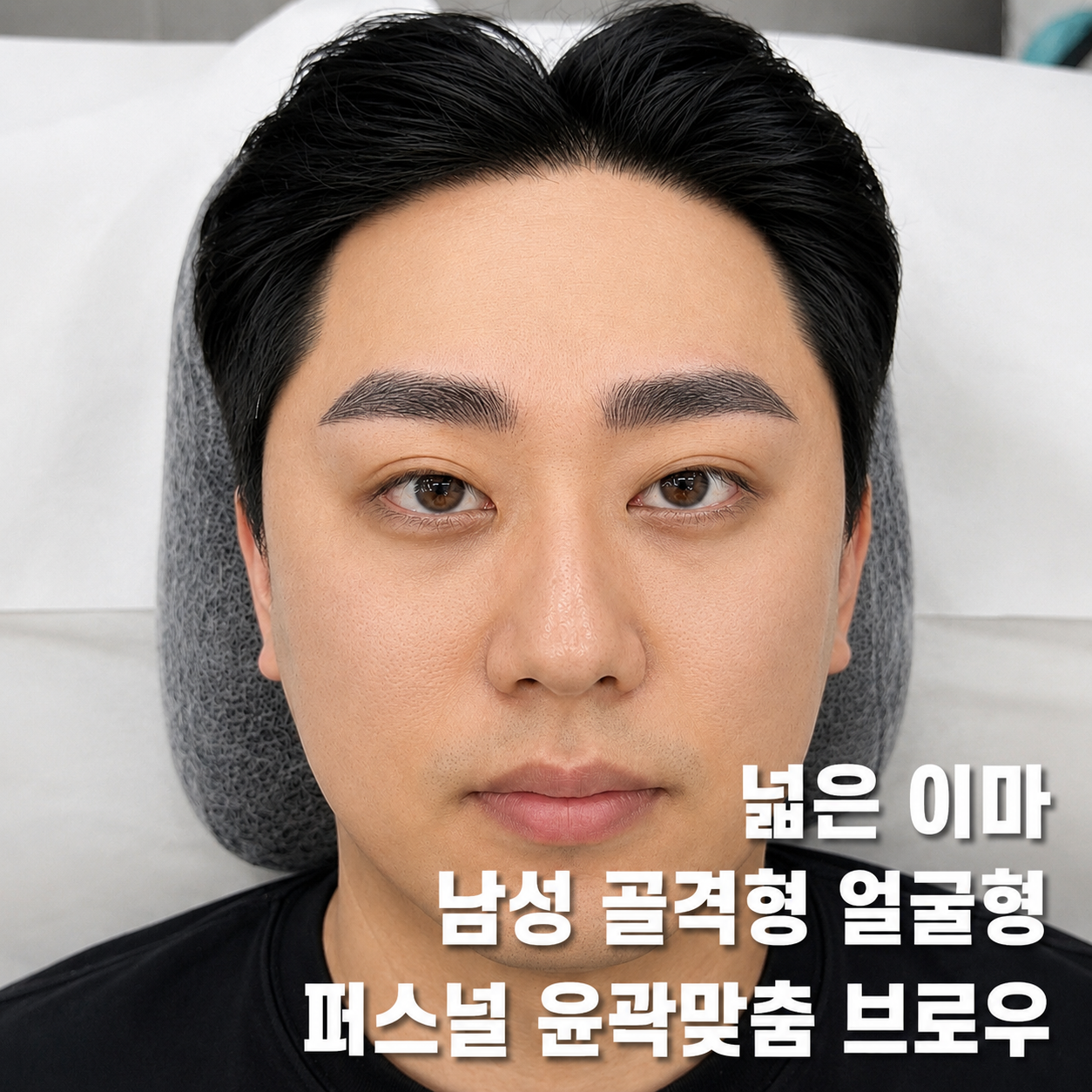 넓은 이마 남성 골격형 얼굴형 눈썹 결과 사진